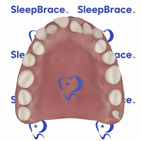 SleepBrace™ Dental