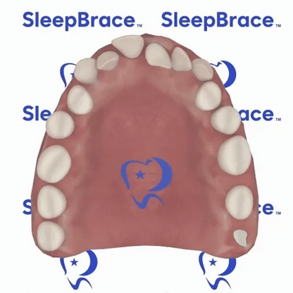 SleepBrace™ Dental