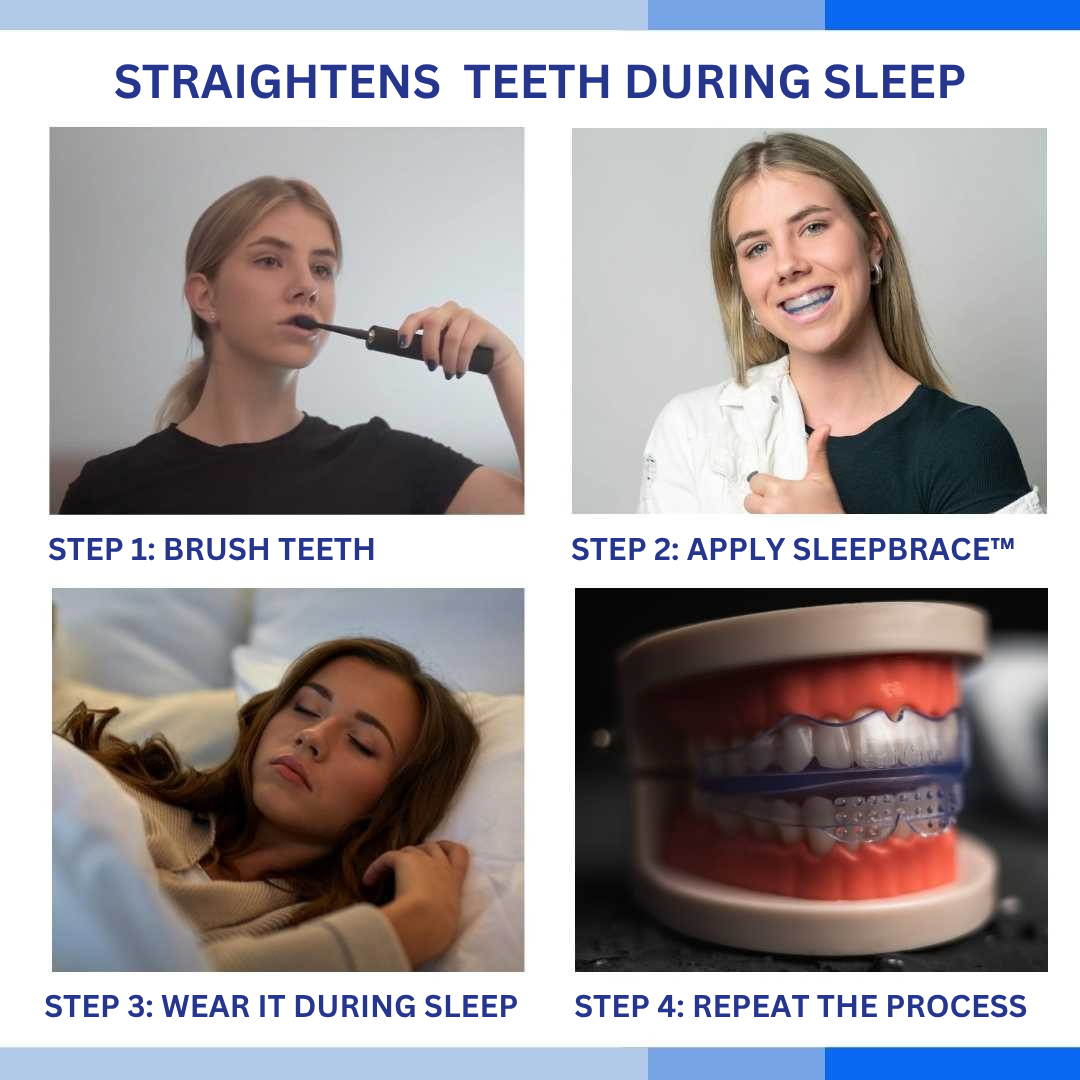 SleepBrace™ Dental